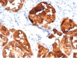 IHC staining of FFPE human kidney tissue with FABP1 antibody (clone FABP1/3485). HIER: boil tissue sections in pH 9 10mM Tris with 1mM EDTA for 20 min and allow to cool before testing.