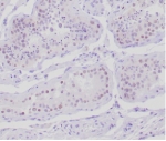IHC staining of FFPE human testis tissue with Anti-Mullerian Hormone antibody (clone AMH/300). HIER: boil tissue sections in pH 9 10mM Tris with 1mM EDTA for 20 min and allow to cool before testing.