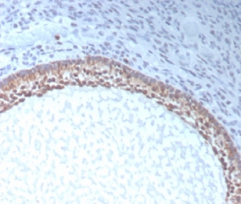 IHC staining of FFPE human ovarian tissue with Anti-Mullerian Hormone antibody (clone AMH/300). HIER: boil tissue sections in pH 9 10mM Tris with 1mM EDTA for 20 min and allow to cool before testing.~