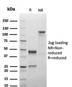 SDS-PAGE analysis of purified, BSA-free recombinant Growth Hormone antibody (clone GH/4886R) as confirmation of integrity and purity.