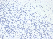 Negative control: IHC staining of FFPE human brain tissue using recombinant Growth Hormone antibody (clone rGH/4887) at 2ug/ml in PBS for 30min RT. HIER: boil tissue sections in pH 9 10mM Tris with 1mM EDTA for 20 min and allow to cool before testing.