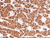 IHC staining of FFPE human pituitary tissue with recombinant Growth Hormone antibody (clone GH/4886R). HIER: boil tissue sections in pH 9 10mM Tris with 1mM EDTA for 20 min and allow to cool before testing.