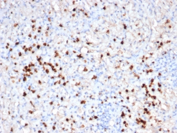 IHC staining of FFPE human spleen tissue with recombinant Granzyme B antibody (clone GZMB/6530R). HIER: boil tissue sections in pH 9 10mM Tris with 1mM EDTA for 20 min and allow to cool before testing.