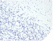 Negative control: IHC staining of FFPE human brain tissue using recombinant GH1 antibody (clone rGH/4887) at 2ug/ml in PBS for 30min RT. HIER: boil tissue sections in pH 9 10mM Tris with 1mM EDTA for 20 min and allow to cool before testing.