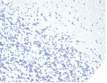 Negative control: IHC staining of FFPE h