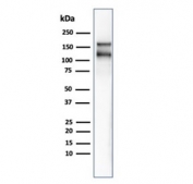 Western blot testing of human HCT-116 cell lysate using recombinant MSH6 antibody (clone MSH6/4592R). Expected molecular weight: 120-160 kDa depending on phosphorylation level.