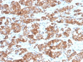 IHC staining of FFPE human pituitary tissue with recombinant Luteinizing Hormone beta antibody (clone LHb/1612R). HIER: boil tissue sections in pH 9 10mM Tris with 1mM EDTA for 20 min and allow to cool before testing.~