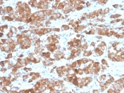 IHC staining of FFPE human pituitary tissue with recombinant Luteinizing Hormone beta antibody (clone LHb/1612R). HIER: boil tissue sections in pH 9 10mM Tris with 1mM EDTA for 20 min and allow to cool before testing.