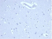 Negative control: IHC staining of FFPE human brain tissue using recombinant Ki67 antibody (clone MKI67/4947R) at 2ug/ml in PBS for 30min RT. HIER: boil tissue sections in pH 9 10mM Tris with 1mM EDTA for 20 min and allow to cool before testing.