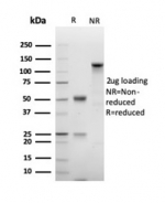 SDS-PAGE analysis of purified, BSA-free recombinant Ki67 antibody (clone MKI67/4947R) as confirmation of integrity and purity.