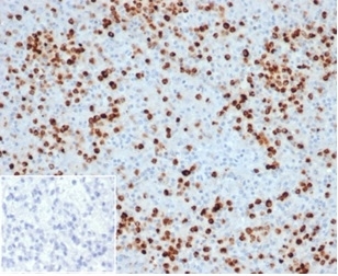 IHC staining of FFPE human spleen tissue with recombinant Myeloperoxidase antibody (clone MPO/33R). Negative control inset: PBS instead of primary antibody to control for secondary binding. HIER: boil tissue sections in pH 9 10mM Tris with 1mM EDTA for 20 min and allow to cool before testing.