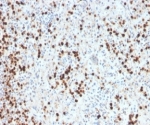 IHC staining of FFPE human spleen tissue with recombinant Myeloperoxidase antibody (clone MPO/33R). HIER: boil tissue sections in pH 9 10mM Tris with 1mM EDTA for 20 min and allow to cool before testing.