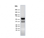 Western blot testing of human spleen lysate using Myeloperoxidase antibody. Expected molecular weight: 59-64 kDa (alpha chain, may be observed at higher molecular weights due to glycosylation), 150+ kDa (glycosylated mature form).