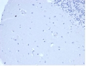 Negative control: IHC staining of FFPE human brain tissue using PRL antibody (clone rPRL/4907) at 2ug/ml in PBS for 30min RT. HIER: boil tissue sections in pH 9 10mM Tris with 1mM EDTA for 20 min and allow to cool before testing.