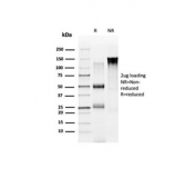SDS-PAGE analysis of purified, BSA-free NOC4L antibody (clone PCRP-NOC4L-1B2) as confirmation of integrity and purity.