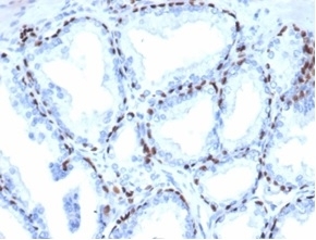 IHC staining of FFPE human prostate tissue with recombinant deltaNp63 antibody (clone P40/4396R). HIER: boil tissue sections in pH 9 10mM Tris with 1mM EDTA for 20 min and allow to cool before testing.