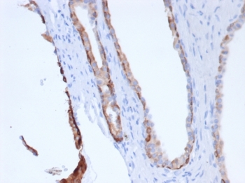 IHC staining of FFPE human prostate tissue with recombinant Pan-CK antibody (clone rPCK/6750). HIER: boil tissue sections in pH 9 10mM Tris with 1mM EDTA for 20 min and allow to cool before testing.~