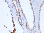 IHC staining of FFPE human prostate tissue with recombinant Pan-CK antibody (clone rPCK/6750). HIER: boil tissue sections in pH 9 10mM Tris with 1mM EDTA for 20 min and allow to cool before testing.