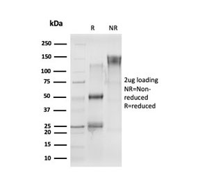 SDS-PAGE analysis of purified, BSA-free CELF2 antibody as confirmation of integrity and purity.