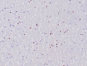 IHC staining of FFPE human cerebellum tissue with recombinant OLIG2 antibody (clone OLIG2/6695R). HIER: boil tissue sections in pH 9 10mM Tris with 1mM EDTA for 20 min and allow to cool before testing.