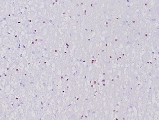 IHC staining of FFPE human cerebellum tissue with recombinant OLIG2 antibody (clone OLIG2/6695R). HIER: boil tissue sections in pH 9 10mM Tris with 1mM EDTA for 20 min and allow to cool before testing.