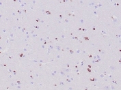 IHC staining of FFPE human cerebrum tissue with recombinant OLIG2 antibody (clone OLIG2/6695R). HIER: boil tissue sections in pH 9 10mM Tris with 1mM EDTA for 20 min and allow to cool before testing.