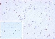 IHC staining of FFPE human brain tissue with recombinant OLIG2 antibody (clone OLIG2/6695R) at 2ug/ml in PBS for 30min RT. Negative control inset: PBS instead of primary antibody to control for secondary Ab binding. HIER: boil tissue sections in pH 9 10mM Tris with 1mM EDTA for 20 min and allow to cool before testing.