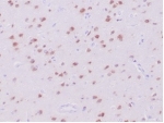 IHC staining of FFPE human cerebrum tissue with recombinant NeuN antibody (clone NeuN/288R). HIER: boil tissue sections in pH 9 10mM Tris with 1mM EDTA for 20 min and allow to cool before testing.
