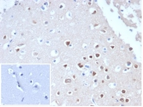 IHC staining of FFPE human cerebellum tissue with recombinant NeuN antibody (clone NeuN/288R). Negative control inset: PBS used instead of primary antibody to control for secondary Ab binding. HIER: boil tissue sections in pH 9 10mM Tris with 1mM EDTA for 20 min and allow to cool before testing.