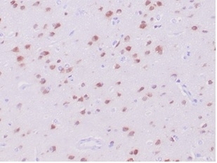 IHC staining of FFPE human cerebrum tissue with recombinant NeuN antibody (clone NeuN/288R). HIER: boil tissue sections in pH 9 10mM Tris with 1mM EDTA for 20 min and allow to cool before testing.