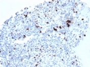 IHC staining of FFPE human tonsil tissue with recombinant TIA-1 antibody (clone TIA/1352R). HIER: boil tissue sections in pH 9 10mM Tris with 1mM EDTA for 20 min and allow to cool before testing.