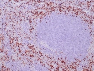 IHC staining of FFPE human spleen tissue with recombinant TIA-1 antibody (clone TIA/1352R). HIER: boil tissue sections in pH 9 10mM Tris with 1mM EDTA for 20 min and allow to cool before testing.