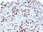 IHC staining of FFPE human lymph node with recombinant TIA-1 antibody (clone TIA/1352R). HIER: boil tissue sections in pH 9 10mM Tris with 1mM EDTA for 20 min and allow to cool before testing.