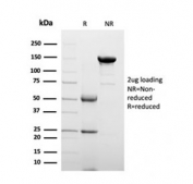SDS-PAGE analysis of purified, BSA-free APO-J antibody (clone CLU/4723) as confirmation of integrity and purity.