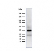 Western blot analysis of human testis lysate using APO-J antibody (clone CLU/4723). Predicted molecular weight: 75-80 kDa (heterodimer precursor), 36-39 kDa (alpha subunit), 34-36 kDa (beta subunit).