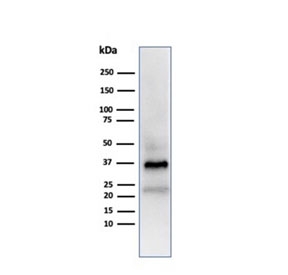 Western blot analysis of human testis lysate using APO-J antibody (clone CLU/4723). Predicted molecular weight: 75-80 kDa (heterodimer precursor), 36-39 kDa (alpha subunit), 34-36 kDa (beta subunit).