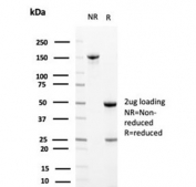 SDS-PAGE analysis of purified, BSA-free Apolipoprotein J antibody (clone CLU/4729) as confirmation of integrity and purity.