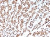 IHC staining of FFPE human adrenal gland tissue with Apolipoprotein J antibody (clone CLU/4729). HIER: boil tissue sections in pH 9 10mM Tris with 1mM EDTA for 20 min and allow to cool before testing.