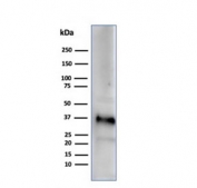 Western blot testing of human testis tissue lysate using Apolipoprotein J antibody (clone CLU/4729). Predicted molecular weight: 75-80 kDa (heterodimer precursor), 36-39 kDa (alpha subunit), 34-36 kDa (beta subunit).