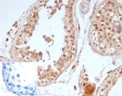 IHC staining of FFPE human testis with recombinant Oct4 antibody (clone OCT4/6875R). Negative control inset: PBS used instead of primary antibody to control for secondary Ab binding. HIER: boil tissue sections in pH 9 10mM Tris with 1mM EDTA for 20 min and allow to cool before testing.