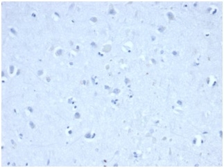 Negative control: IHC staining of FFPE human cerebellum tissue with IDH1 R132H antibody (clone IDH1/6806R) at 2ug/ml in PBS for 30min RT. HIER: boil tissue sections in pH 9 10mM Tris with 1mM EDTA for 20 min and allow to cool before testing.