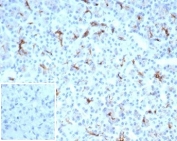 IHC staining of FFPE human pancreatic tissue with recombinant CFTR antibody (clone CFTR/7003R). Negative control inset: PBS used instead of primary antibody to control for secondary Ab binding. HIER: boil tissue sections in pH 9 10mM Tris with 1mM EDTA for 20 min and allow to cool before testing.