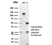 SDS-PAGE analysis of purified, BSA-free recombinant CFTR antibody (clone CFTR/7003R) as confirmation of integrity and purity.