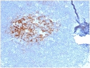 IHC staining of FFPE human lymph node tissue with CD23 antibody (clone FCER2/6887) at 2ug/ml in PBS for 30min RT. HIER: boil tissue sections in pH 9 10mM Tris with 1mM EDTA for 20 min and allow to cool before testing.
