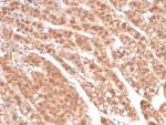 IHC staining of FFPE human adrenal gland tissue with AKR1B1 antibody (clone rAKR1B1/7295). HIER: boil tissue sections in pH 9 10mM Tris with 1mM EDTA for 20 min and allow to cool before testing.