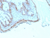 IHC staining of FFPE human skin tissue with recombinant FLG antibody (clone rFLG/1945). HIER: boil tissue sections in pH 9 10mM Tris with 1mM EDTA for 20 min and allow to cool before testing.