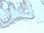 IHC staining of FFPE human skin tissue with recombinant FLG antibody (clone rFLG/1945). HIER: boil tissue sections in pH 9 10mM Tris with 1mM EDTA for 20 min and allow to cool before testing.