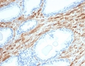 IHC staining of FFPE human prostate tissue with Desmin antibody (clone DES/3255) at 2ug/ml. HIER: boil tissue sections in pH 9 10mM Tris with 1mM EDTA for 20 min and allow to cool before testing.
