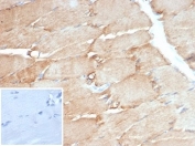 IHC staining of FFPE human skeletal muscle with Desmin antibody (clone DES/3255) at 2ug/ml. Negative control inset: PBS used instead of primary antibody to control for secondary Ab binding. HIER: boil tissue sections in pH 9 10mM Tris with 1mM EDTA for 20 min and allow to cool before testing.