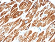 IHC staining of FFPE human cardiac muscle tissue with Desmin antibody (clone DES/3255) at 2ug/ml. HIER: boil tissue sections in pH 9 10mM Tris with 1mM EDTA for 20 min and allow to cool before testing.